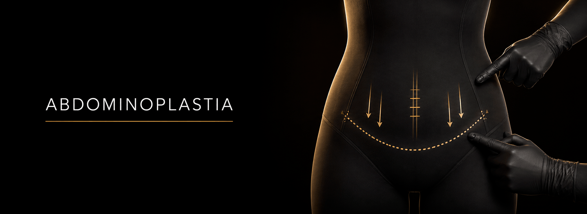 abdomplastia