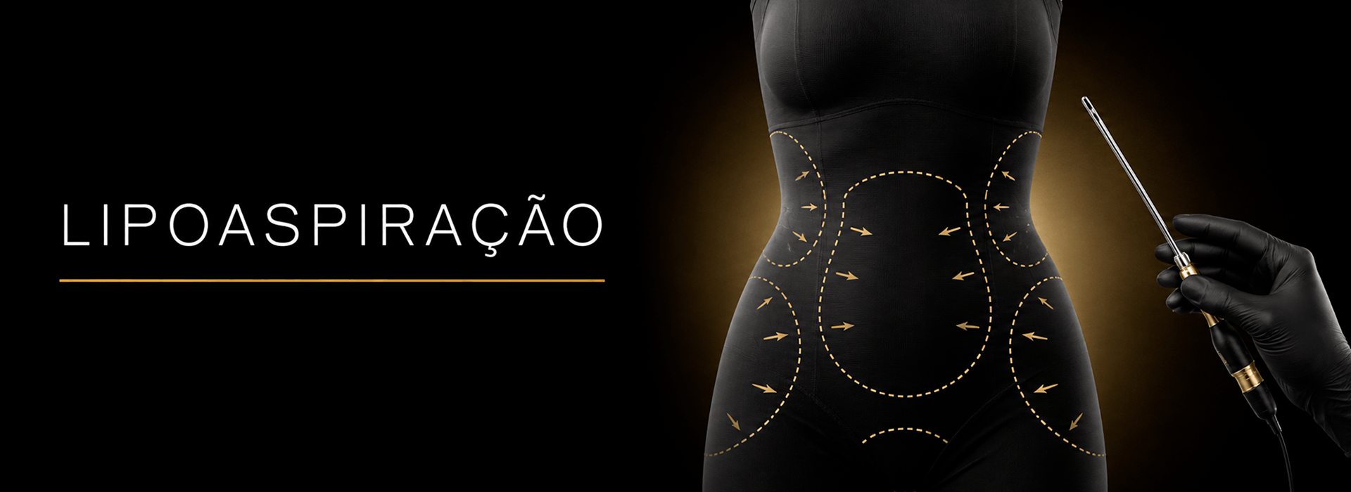 lipoaspiração